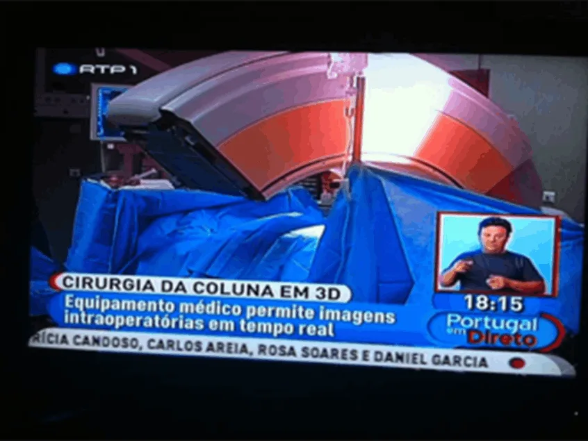 Reportagem televisiva da RTP sobre Cirurgia da Coluna com tecnologia 3D.